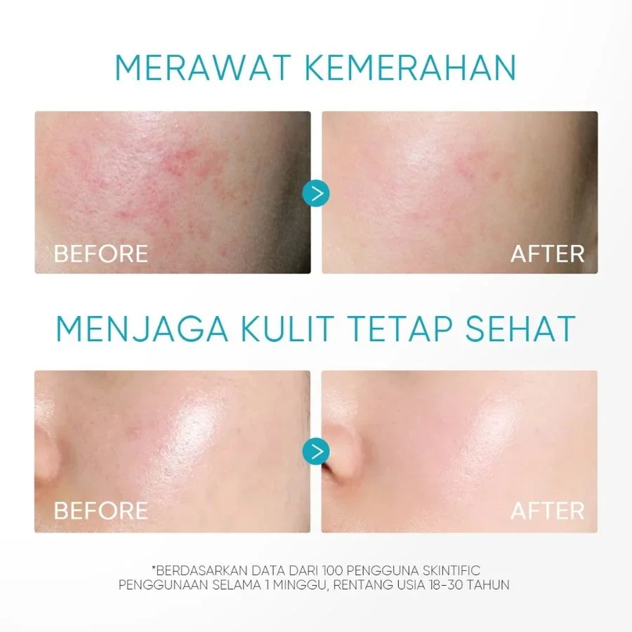 product-thumb-3
