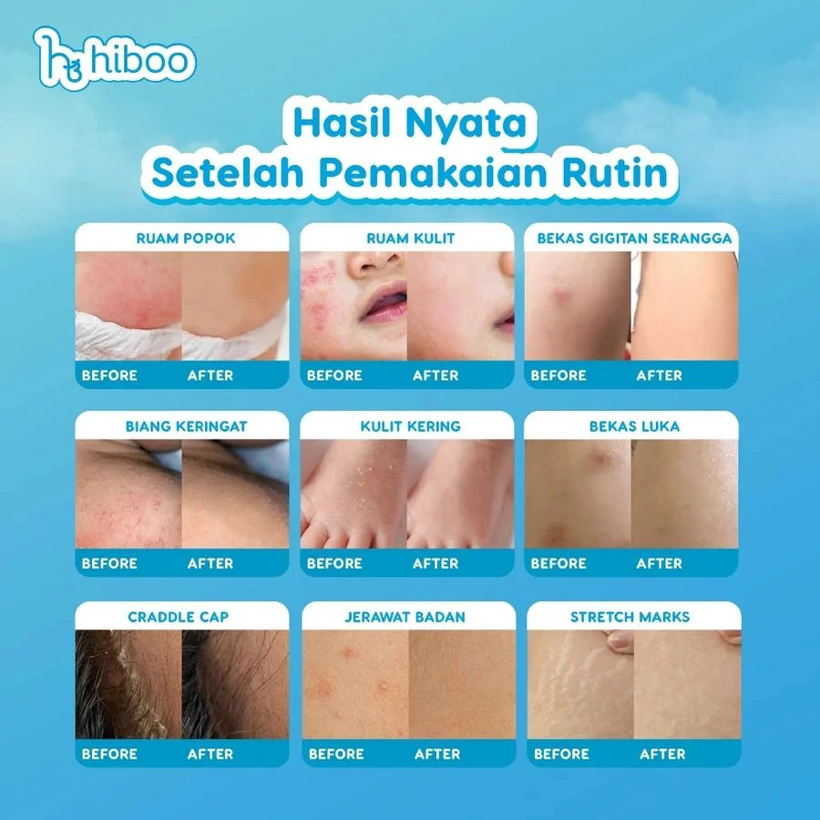 product-thumb-3