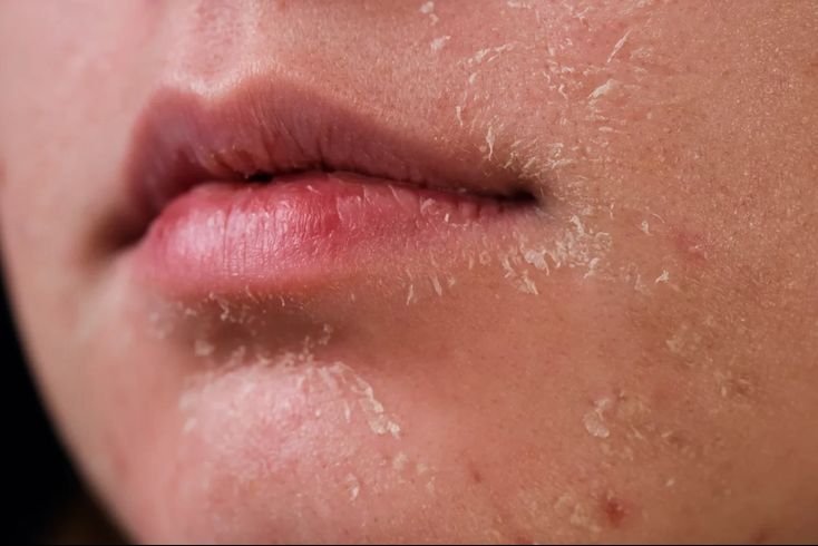 Rekomendasi Moisturizer kulit kering